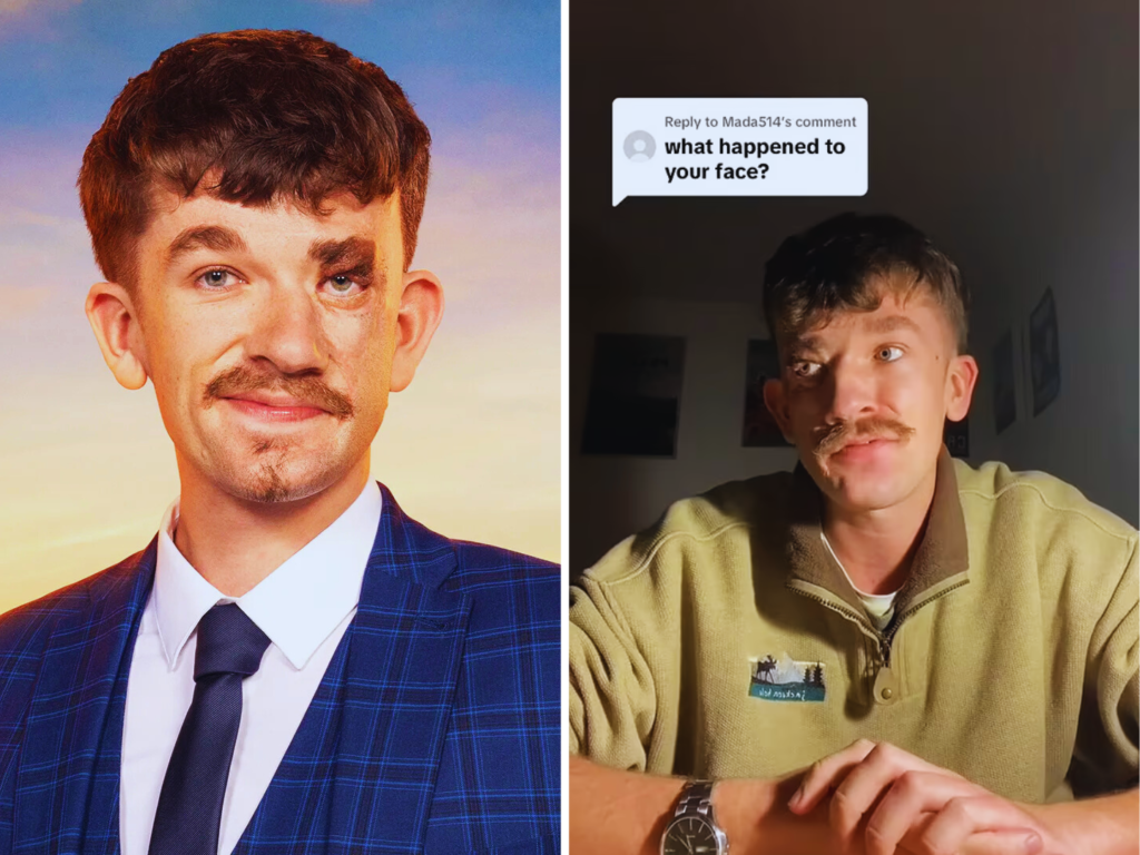 jonny heaver disability